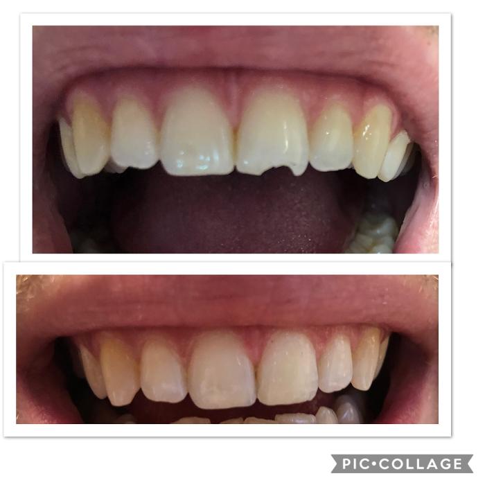 Progressive Dental Image