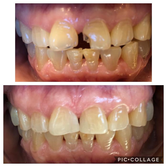 Progressive Dental Image