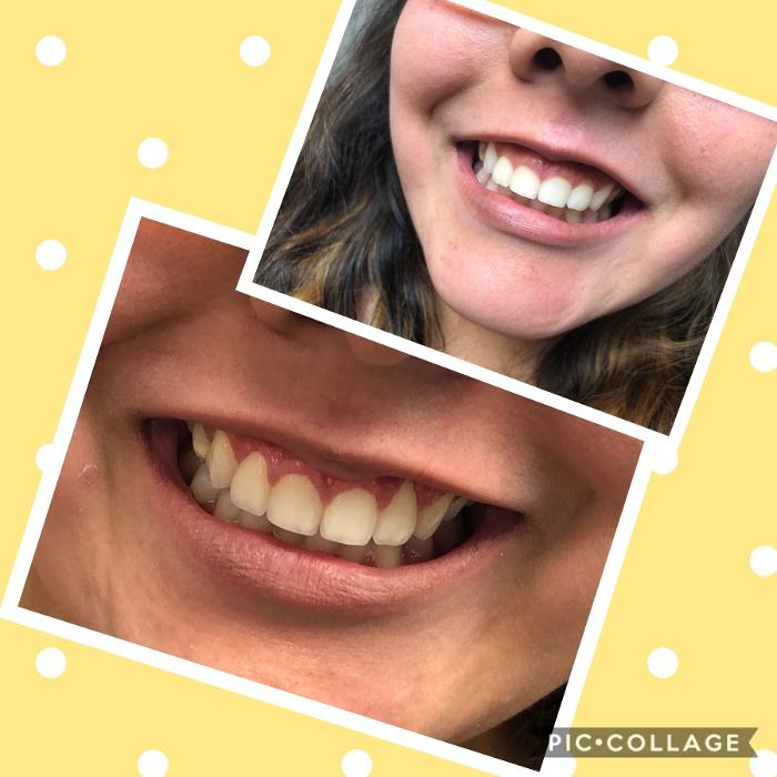 Progressive Dental Image