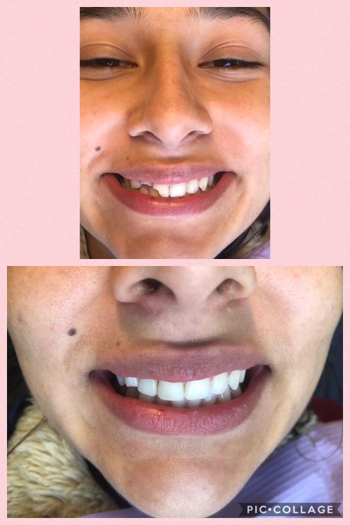 Progressive Dental Image