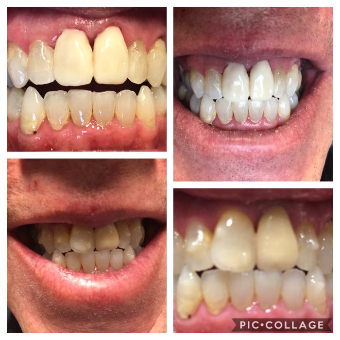 Progressive Dental Image