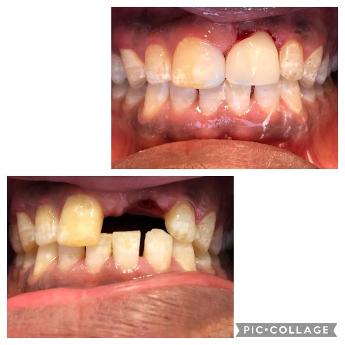Progressive Dental Image