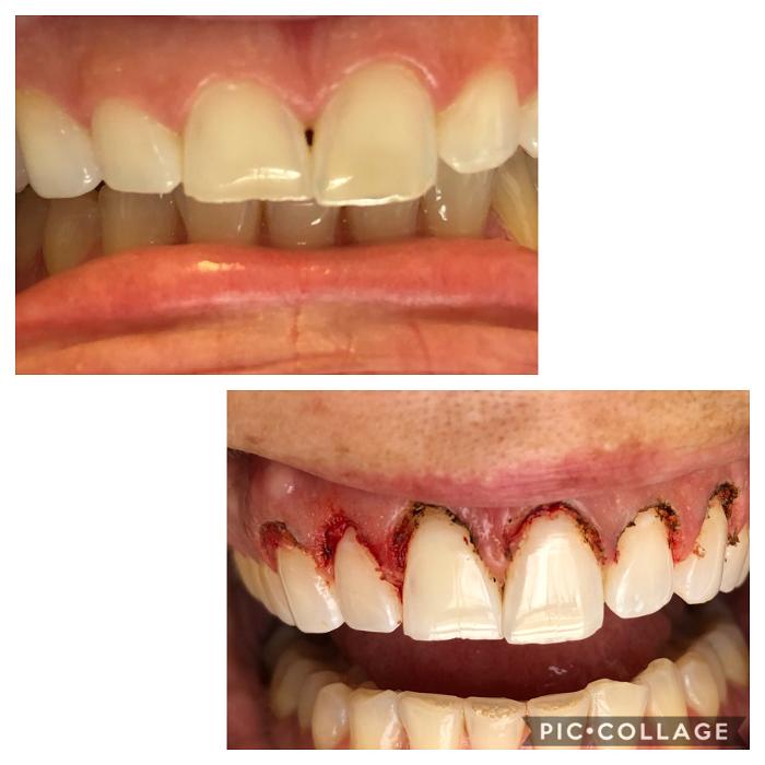 Progressive Dental Image
