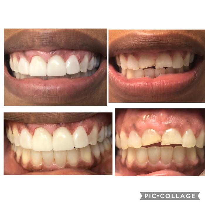 Progressive Dental Image