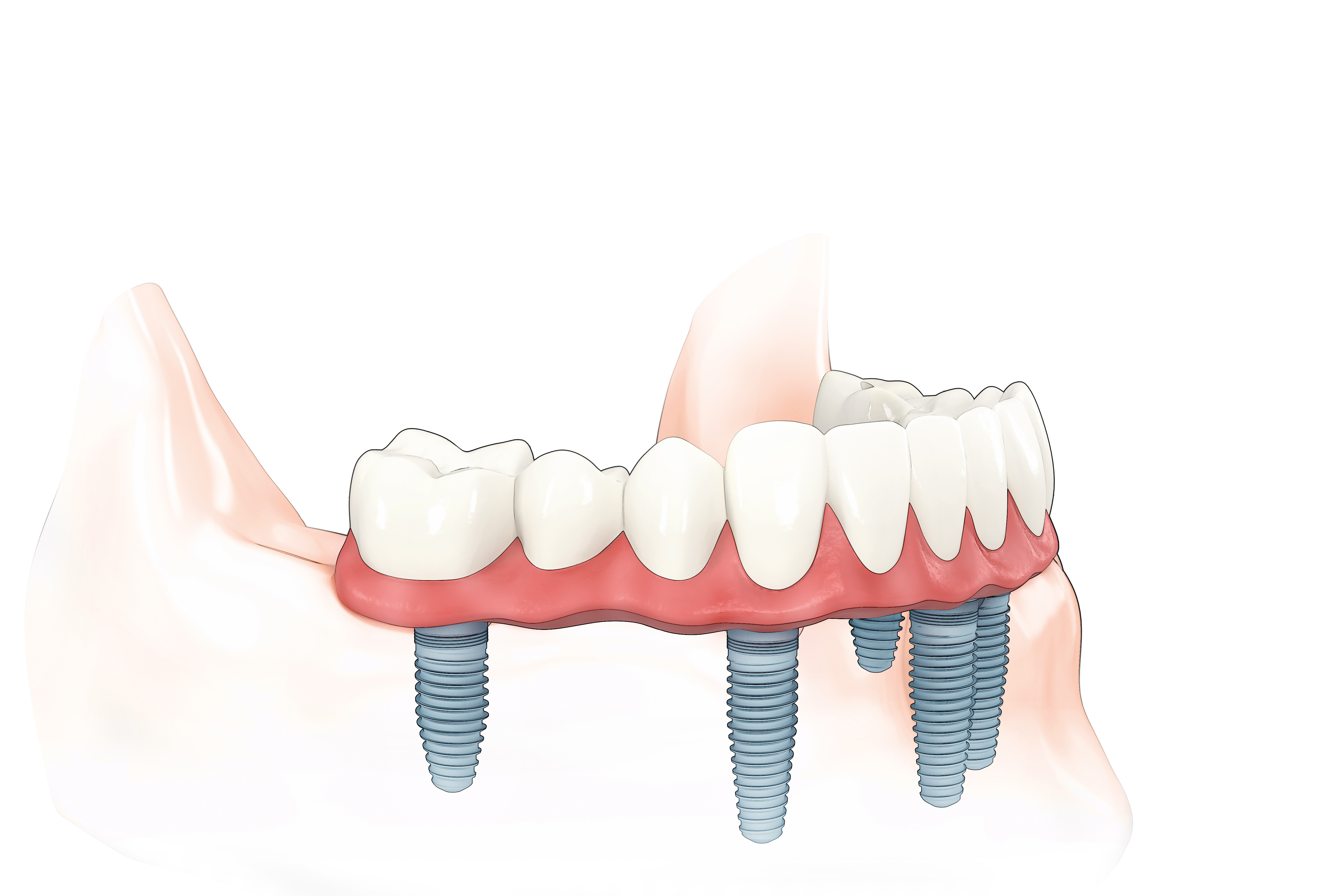 Image 6 | Sayreville Dental