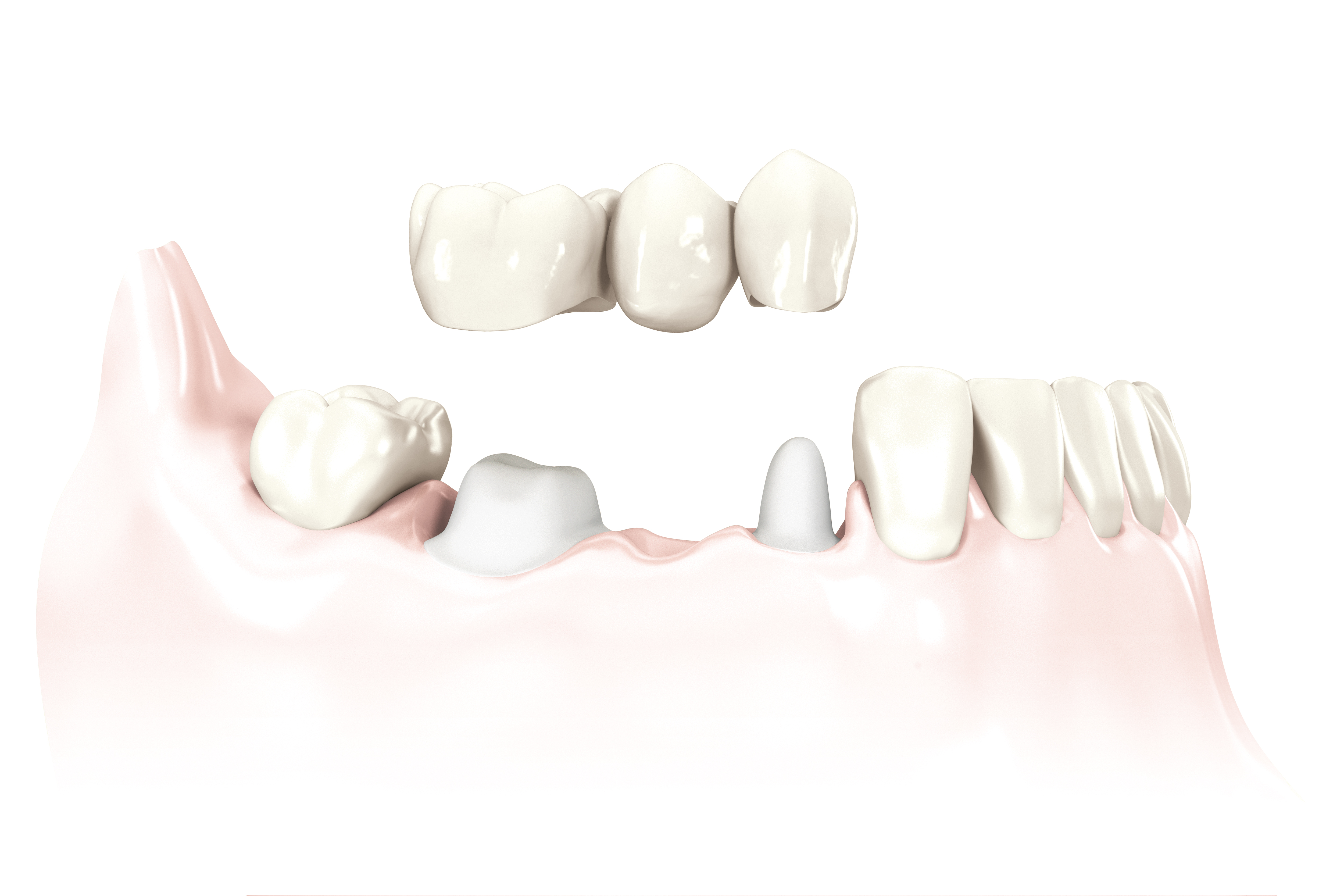 Image 10 | Sayreville Dental