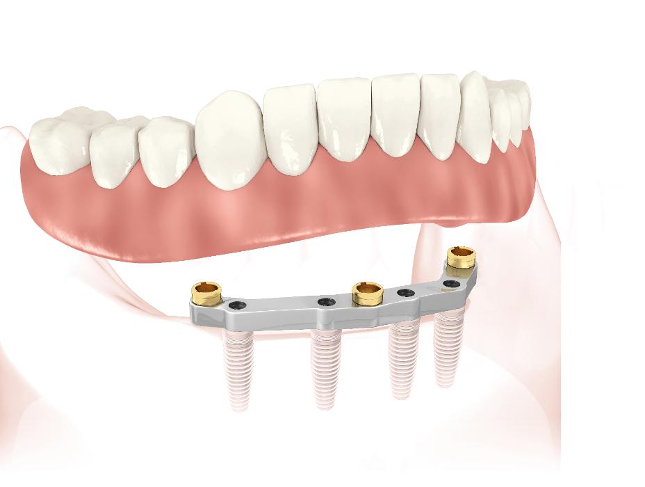 Sayreville Dental - Sayreville, NJ