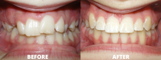 Image 6 | Allegany Orthodontics PC