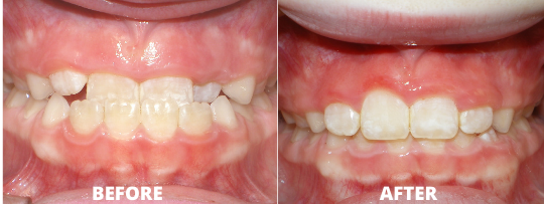 Allegany Orthodontics PC - Cumberland, MD