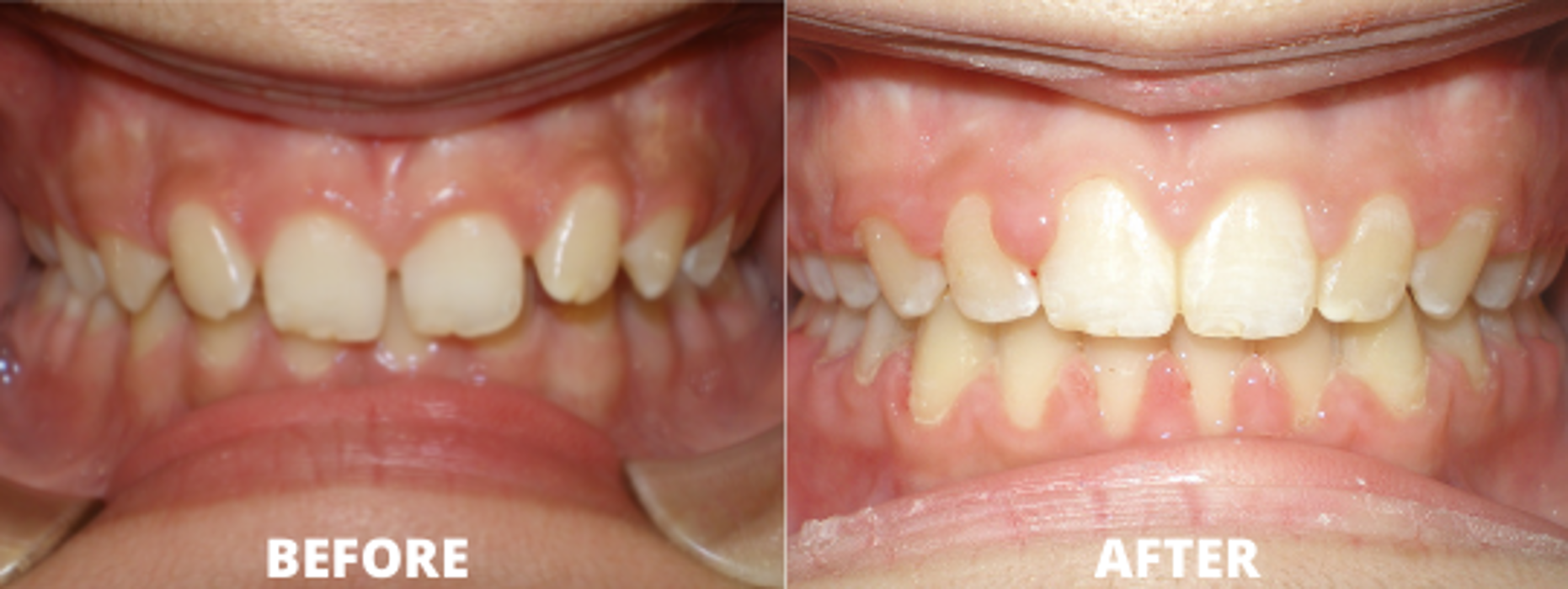 Allegany Orthodontics PC - Cumberland, MD