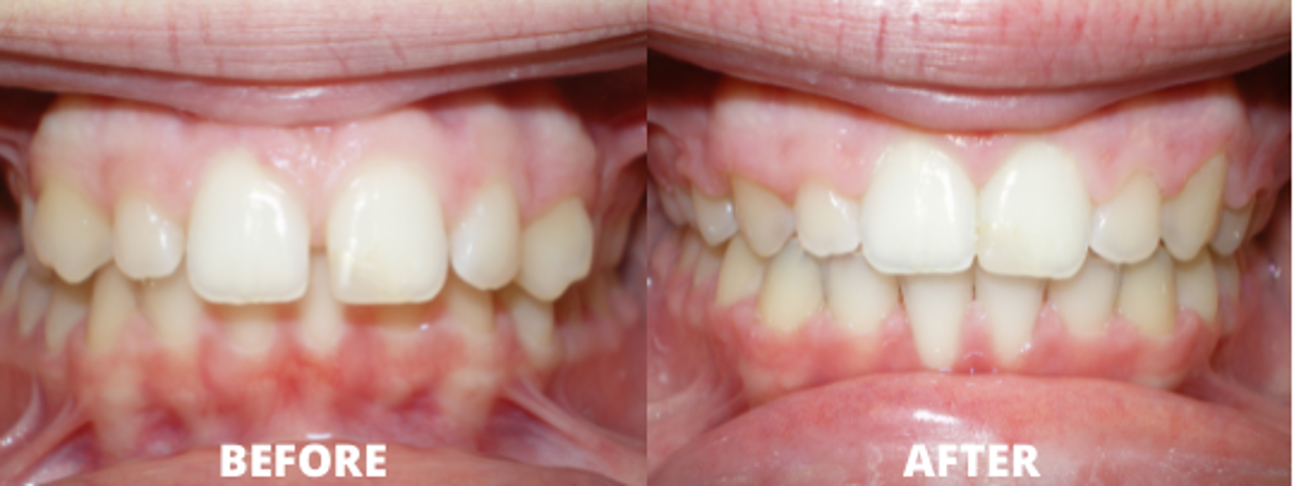 Allegany Orthodontics PC - Cumberland, MD