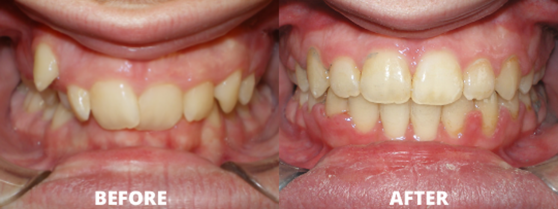 Allegany Orthodontics PC - Cumberland, MD