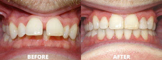 Image 7 | Allegany Orthodontics PC