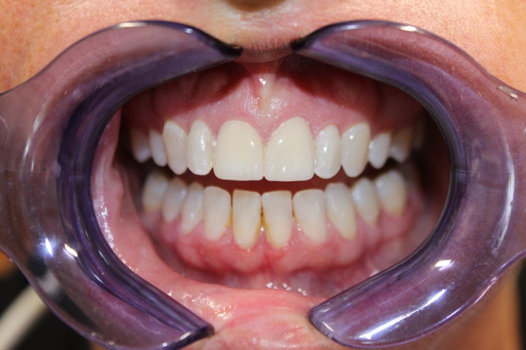 Hamilton Family Dentistry Image