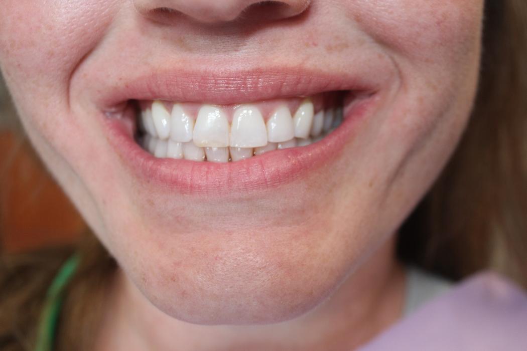 Hamilton Family Dentistry Image