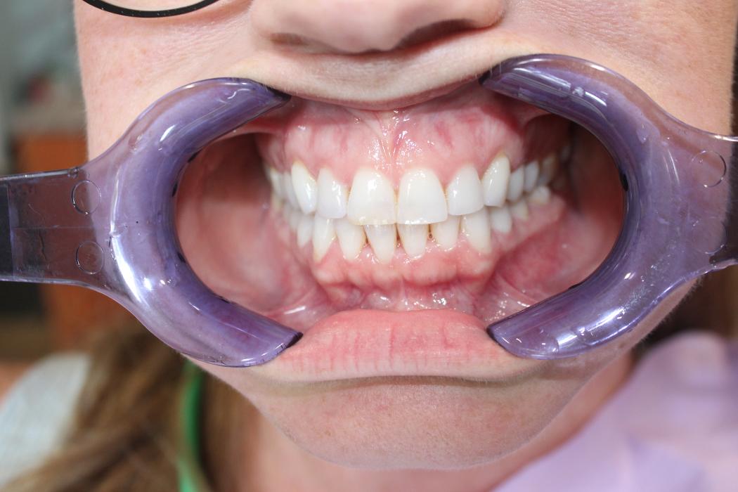 Hamilton Family Dentistry Image