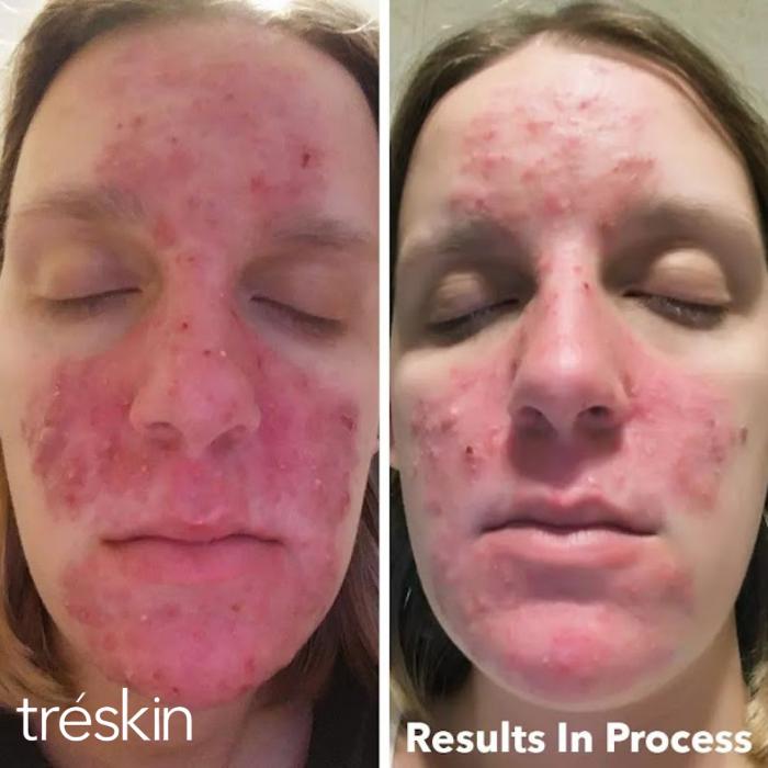 TréSkin - Grand Rapids, MI