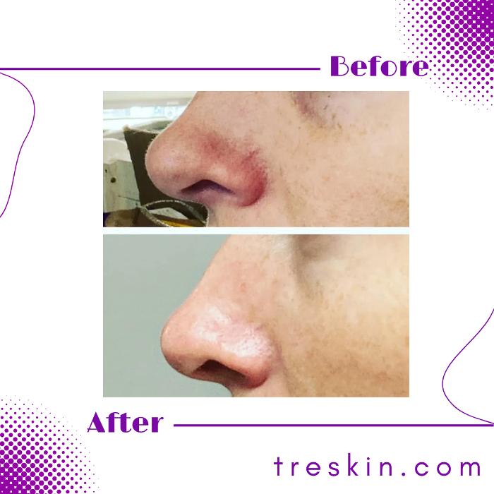 TréSkin - Grand Rapids, MI