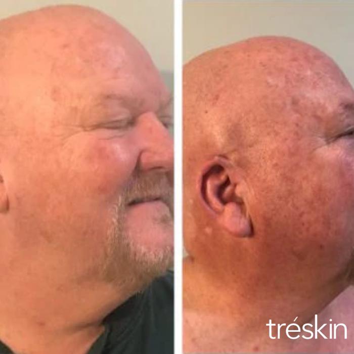 TréSkin - Grand Rapids, MI