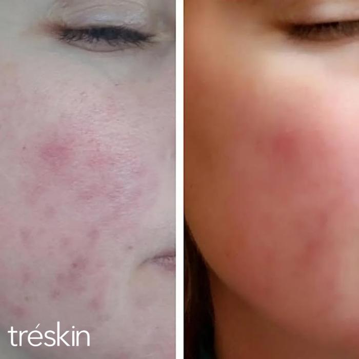 TréSkin - Grand Rapids, MI
