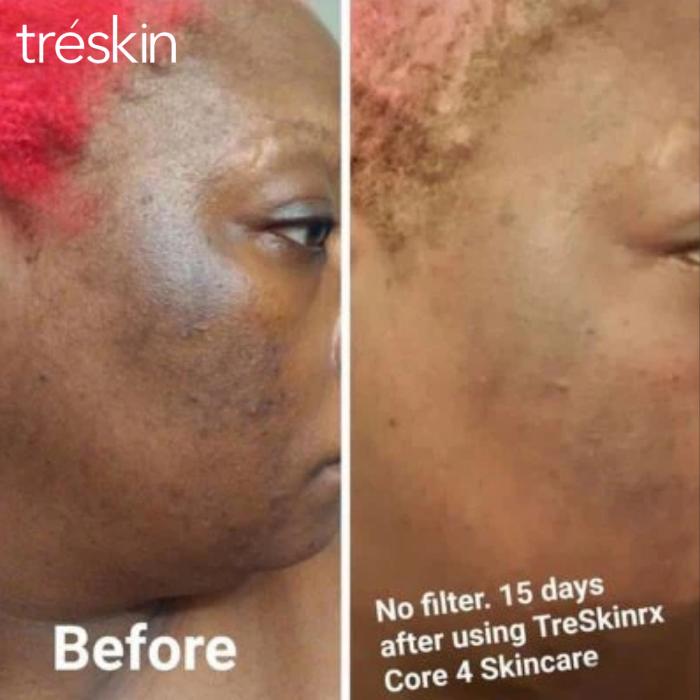 TréSkin - Grand Rapids, MI