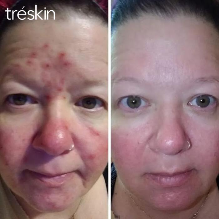 TréSkin - Grand Rapids, MI