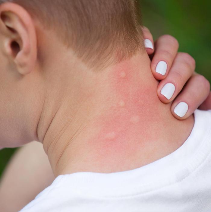 Mosquito Brothers - Hicksville, NY