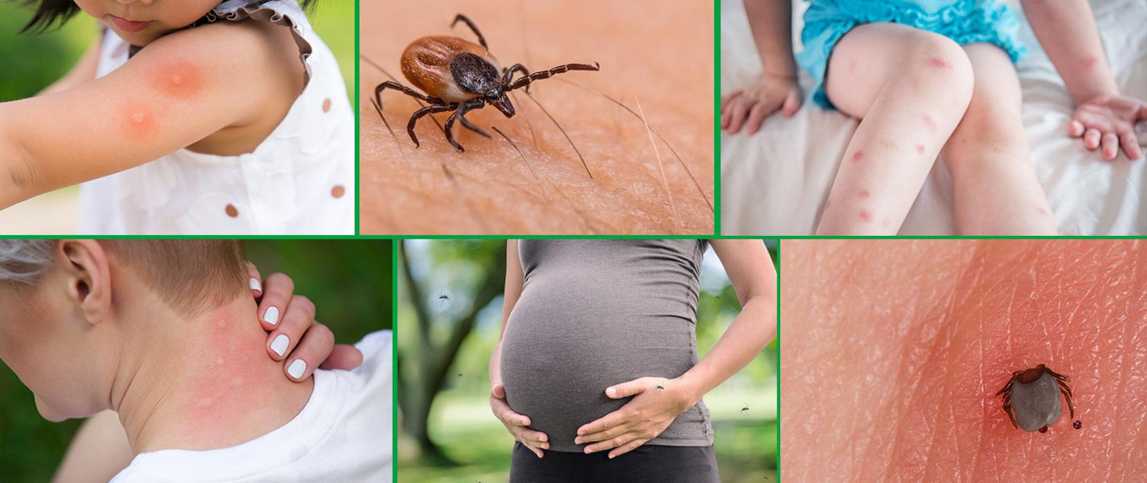 Mosquito Brothers - Hicksville, NY