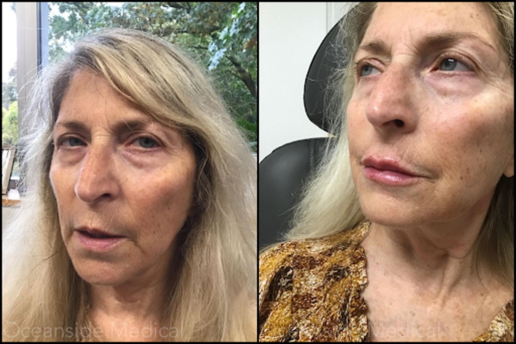 Oceanside Medical - Aesthetics - Warwick, RI