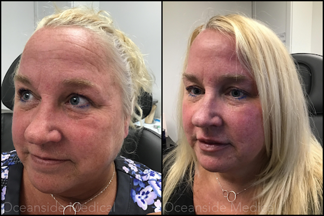 Oceanside Medical - Aesthetics - Warwick, RI