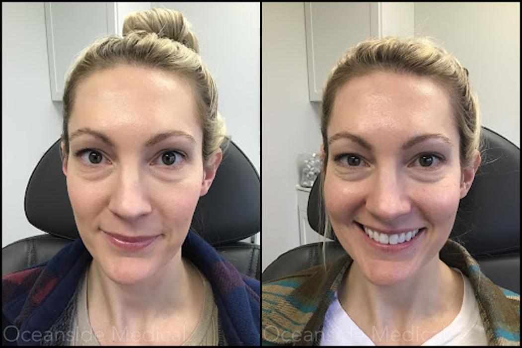 Oceanside Medical - Aesthetics - Warwick, RI