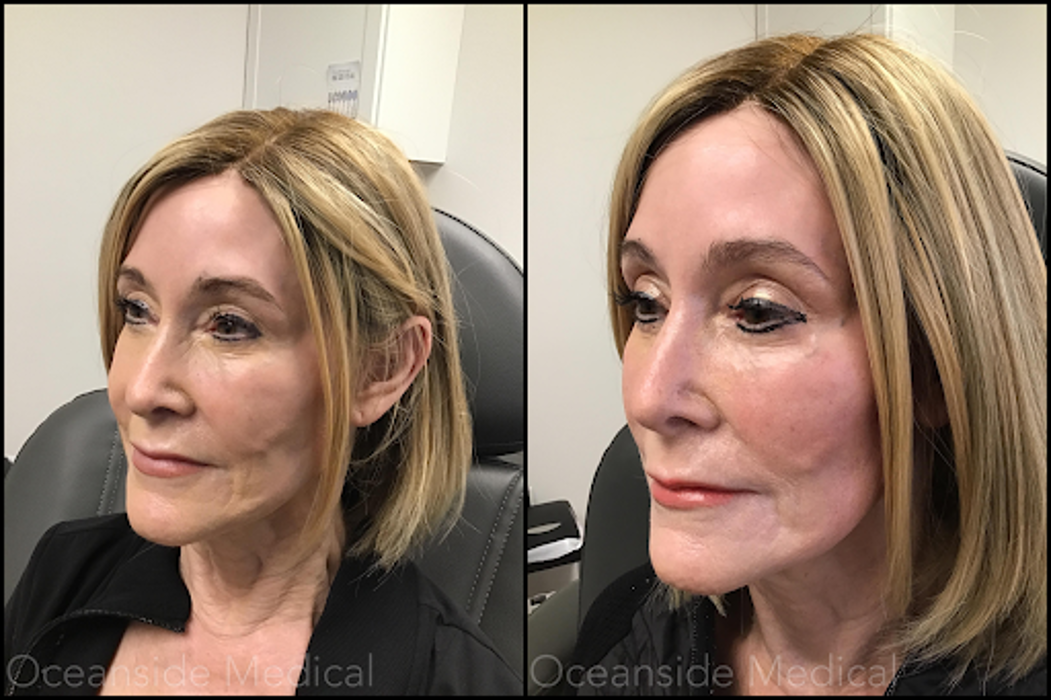 Oceanside Medical - Aesthetics - Warwick, RI