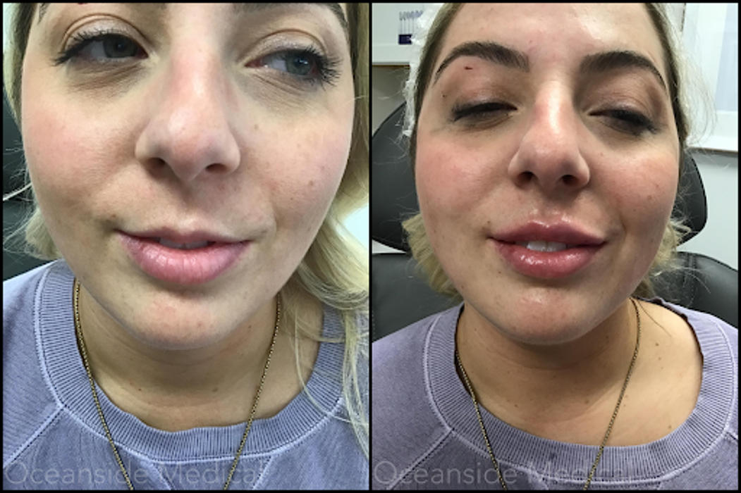 Oceanside Medical - Aesthetics - Warwick, RI