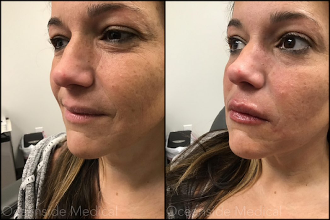 Oceanside Medical - Aesthetics - Warwick, RI