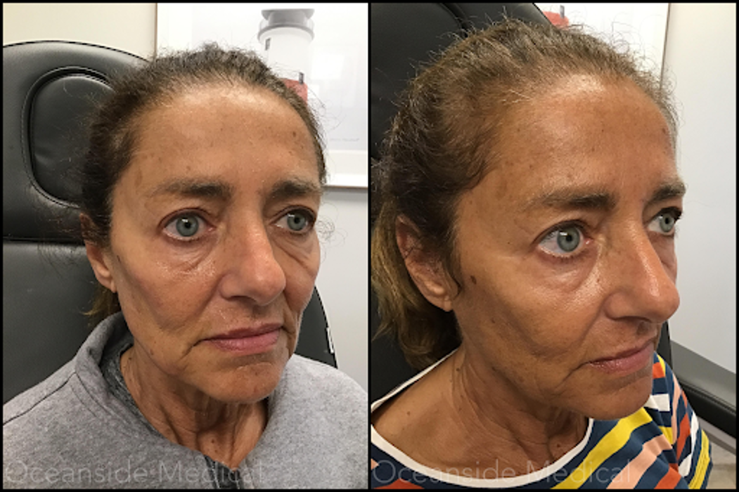 Oceanside Medical - Aesthetics - Warwick, RI