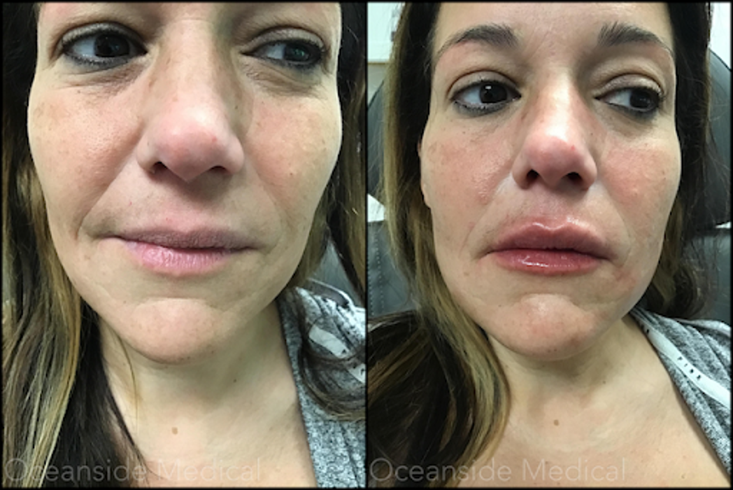 Oceanside Medical - Aesthetics - Warwick, RI