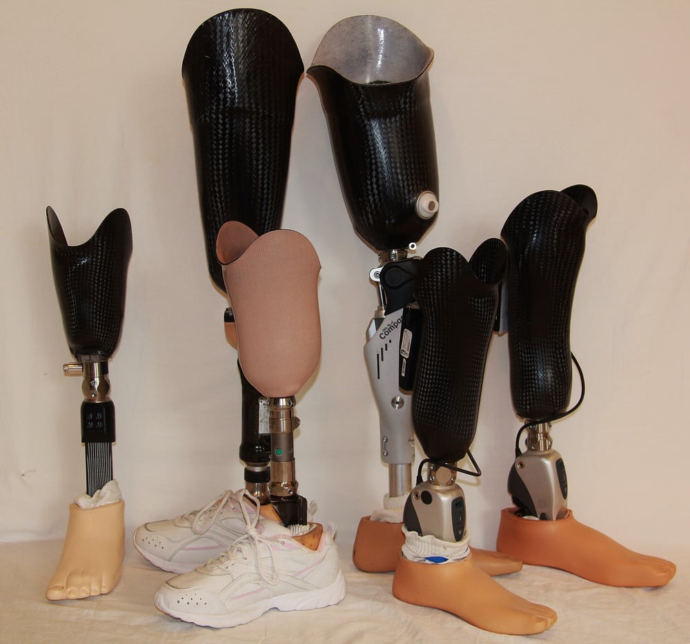 Forrester Custom Prosthetics - Reno, NV 89502 - (775)657-9500 | ShowMeLocal.com