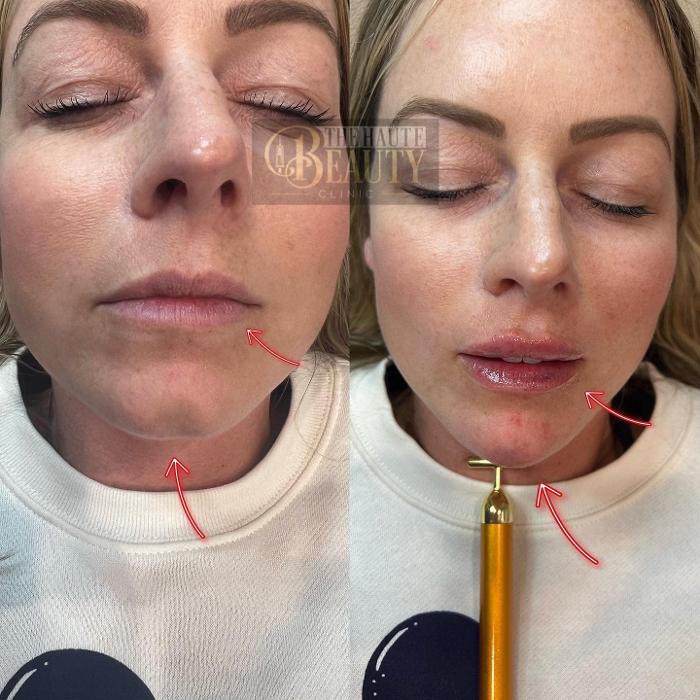The Haute Beauty Clinic - Clermont, FL