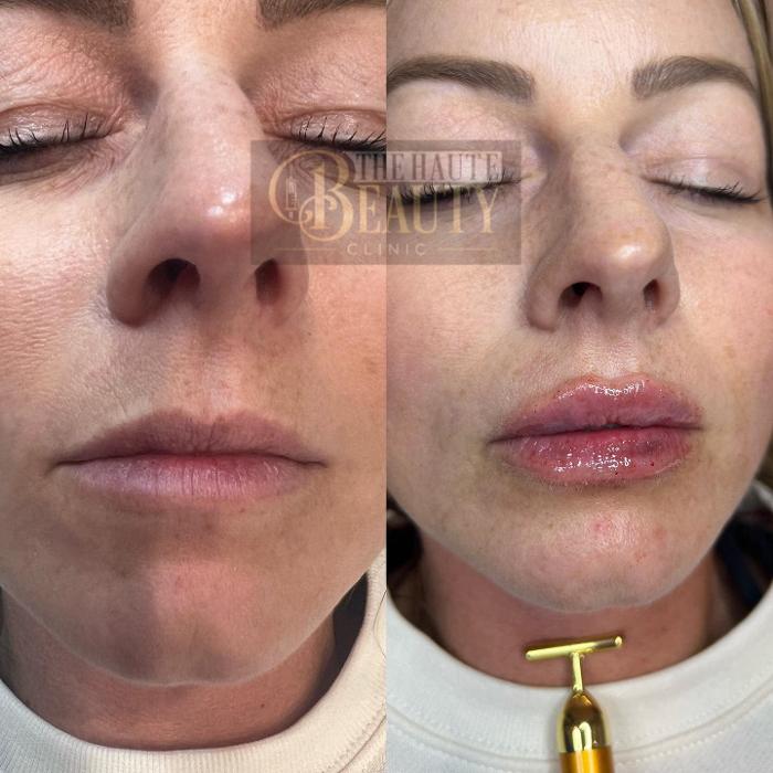 The Haute Beauty Clinic - Clermont, FL