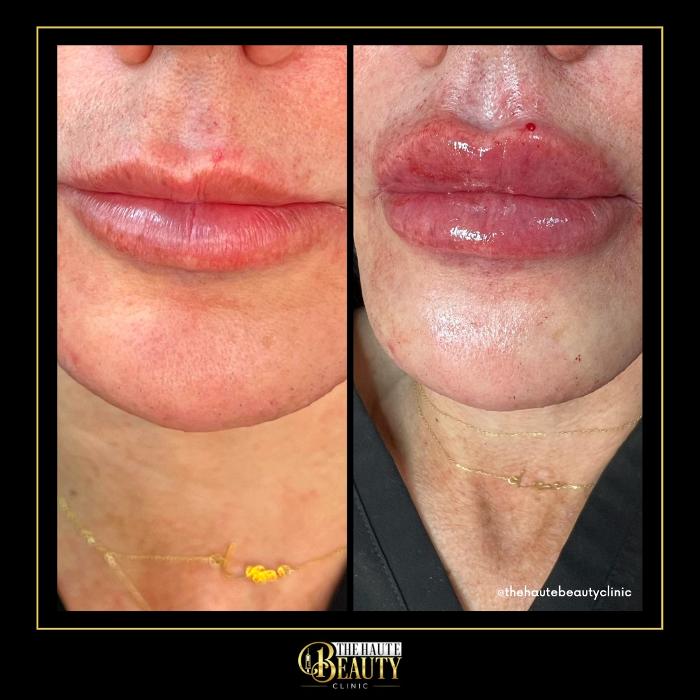 The Haute Beauty Clinic - Clermont, FL