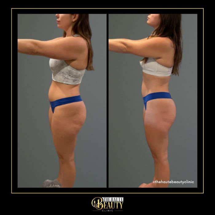 The Haute Beauty Clinic - Clermont, FL