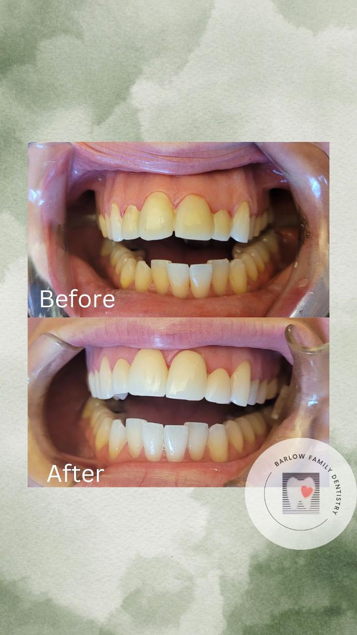 Barlow Family Dentistry Image