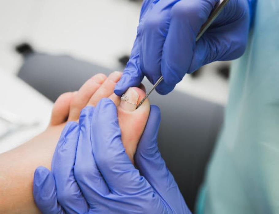 Annapolis Foot & Ankle Center - Chester, MD
