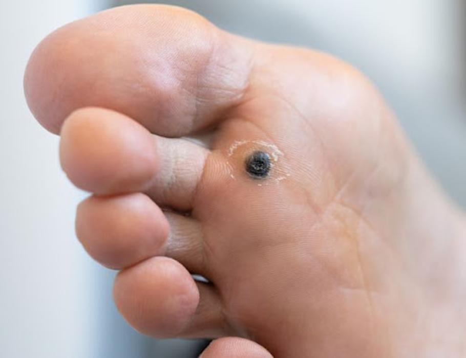 Annapolis Foot & Ankle Center - Chester, MD