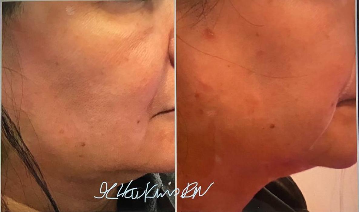Uptown MediSpa - Prior Lake, MN