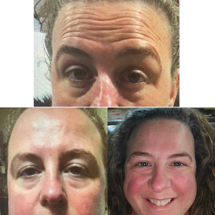 Uptown MediSpa - Prior Lake, MN