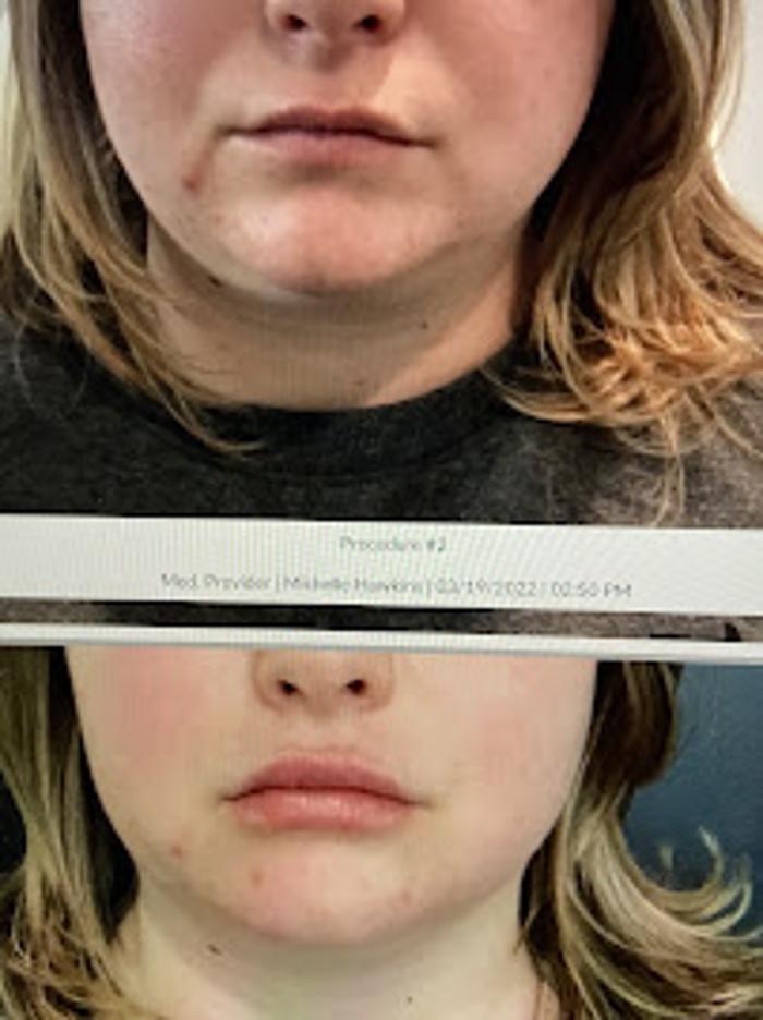 Uptown MediSpa - Prior Lake, MN