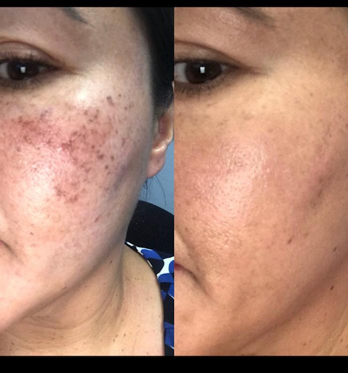 NuYu Rejuvenation Spa - Hot Springs National Park, AR