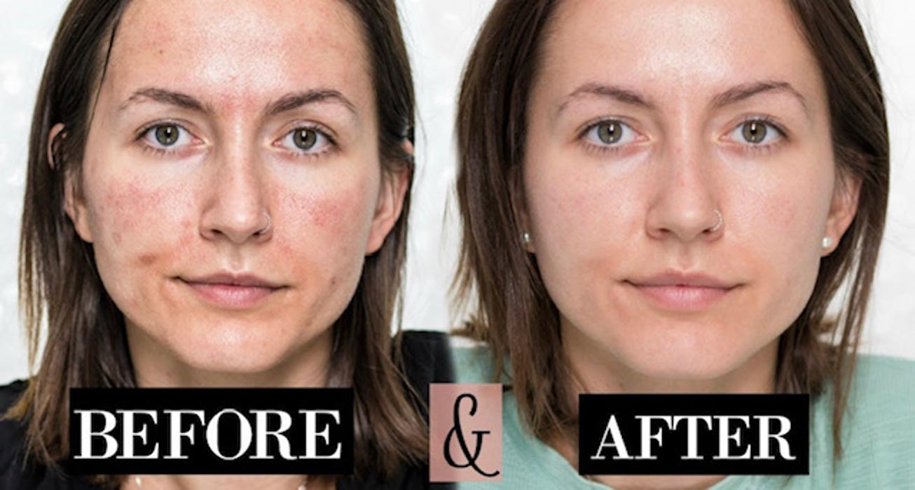 NuYu Rejuvenation Spa - Hot Springs National Park, AR