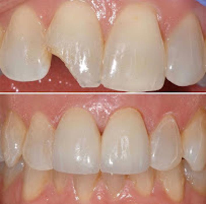 Laurel Bowie Implant & Cosmetic Dentistry Image